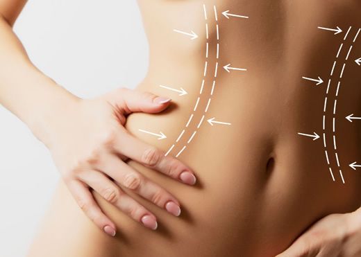 Пластика живота